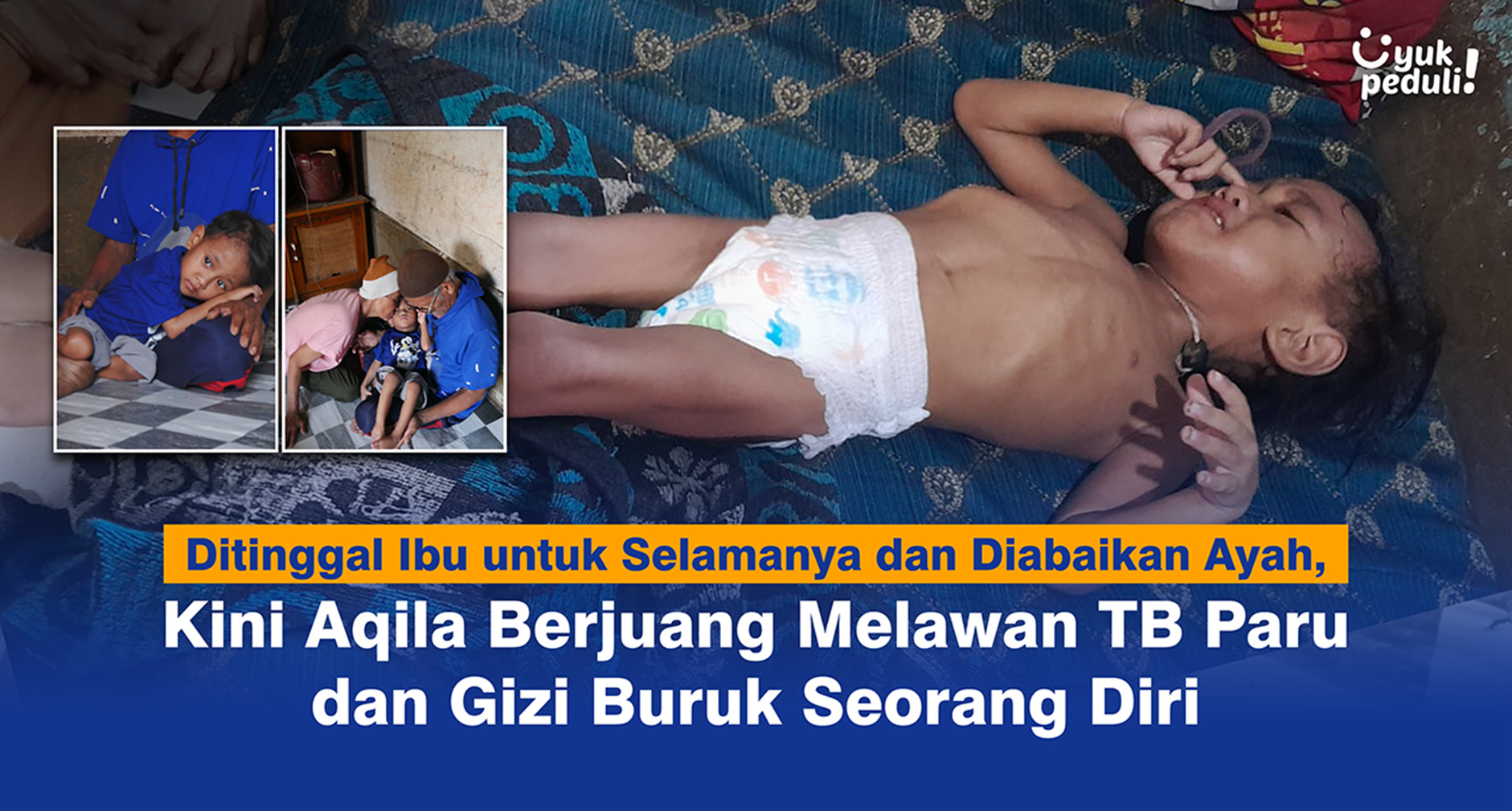 Bantu Aqila Sembuh Dari TB Paru dan Gizi Buruk Dideritanya